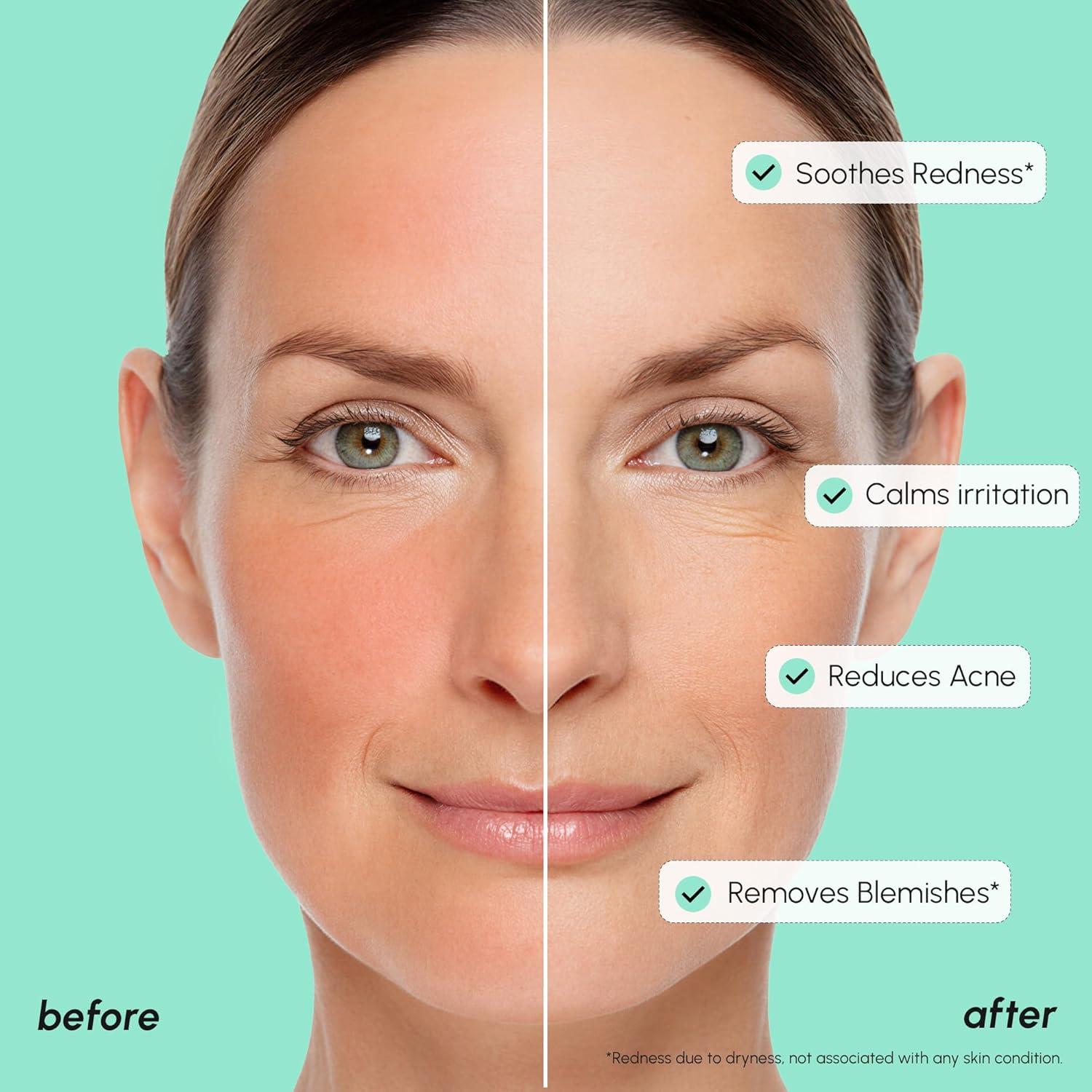 imageMAREE 20 Tranexamic Acid Serum Complex with Niacinamide amp Vitamin C Serum for Face amp Body Dark Spot Corrector Age Spots Hyperpigmentation Care Remover Brightening Acido Tranexamico para ManchasAzelaic Acid Face Serum