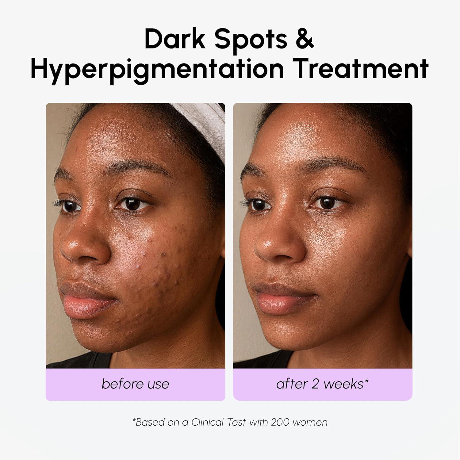 imageMAREE 20 Tranexamic Acid Serum Complex with Niacinamide amp Vitamin C Serum for Face amp Body Dark Spot Corrector Age Spots Hyperpigmentation Care Remover Brightening Acido Tranexamico para ManchasTranexamic Acid Face Serum