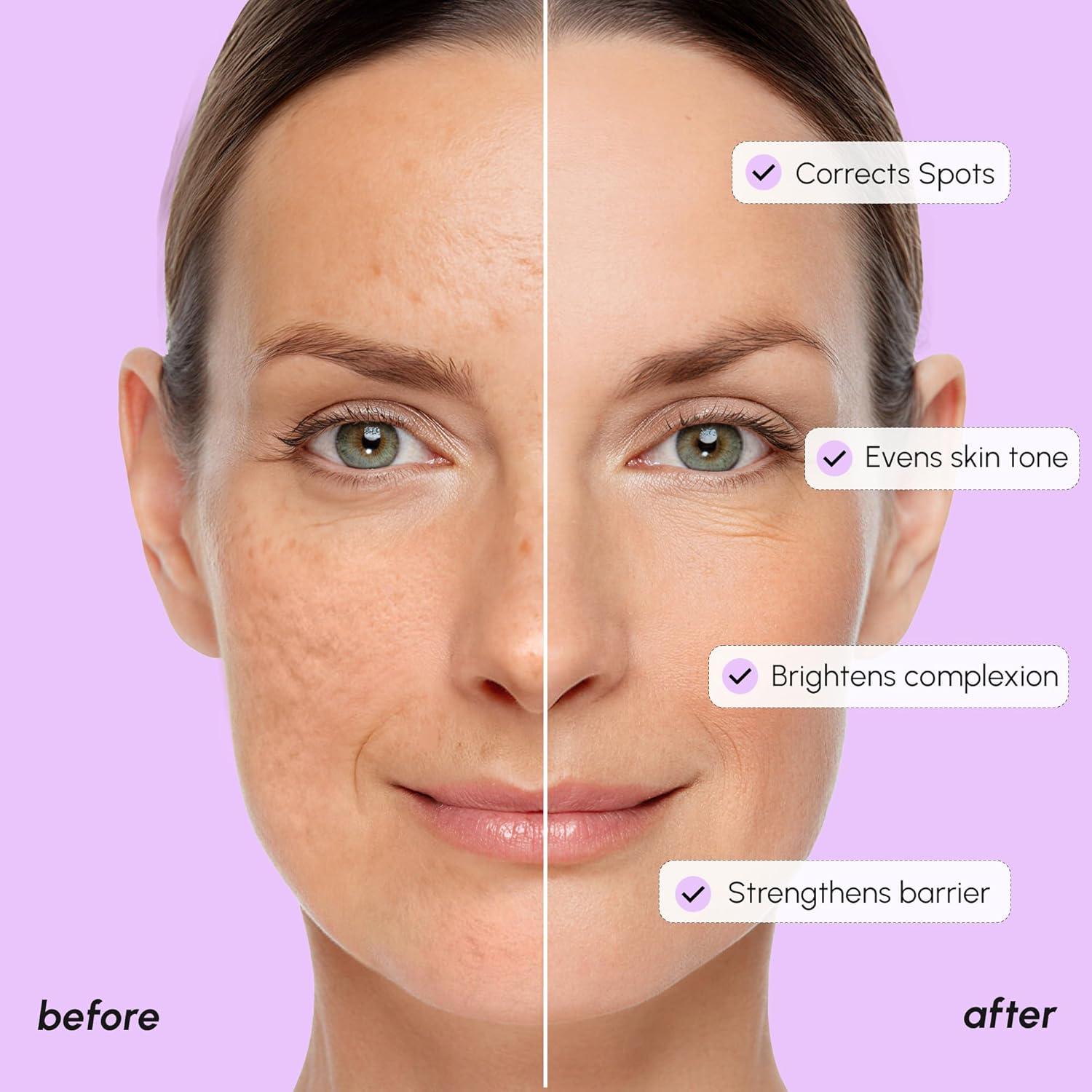 imageMAREE 20 Tranexamic Acid Serum Complex with Niacinamide amp Vitamin C Serum for Face amp Body Dark Spot Corrector Age Spots Hyperpigmentation Care Remover Brightening Acido Tranexamico para ManchasTranexamic Acid Face Serum