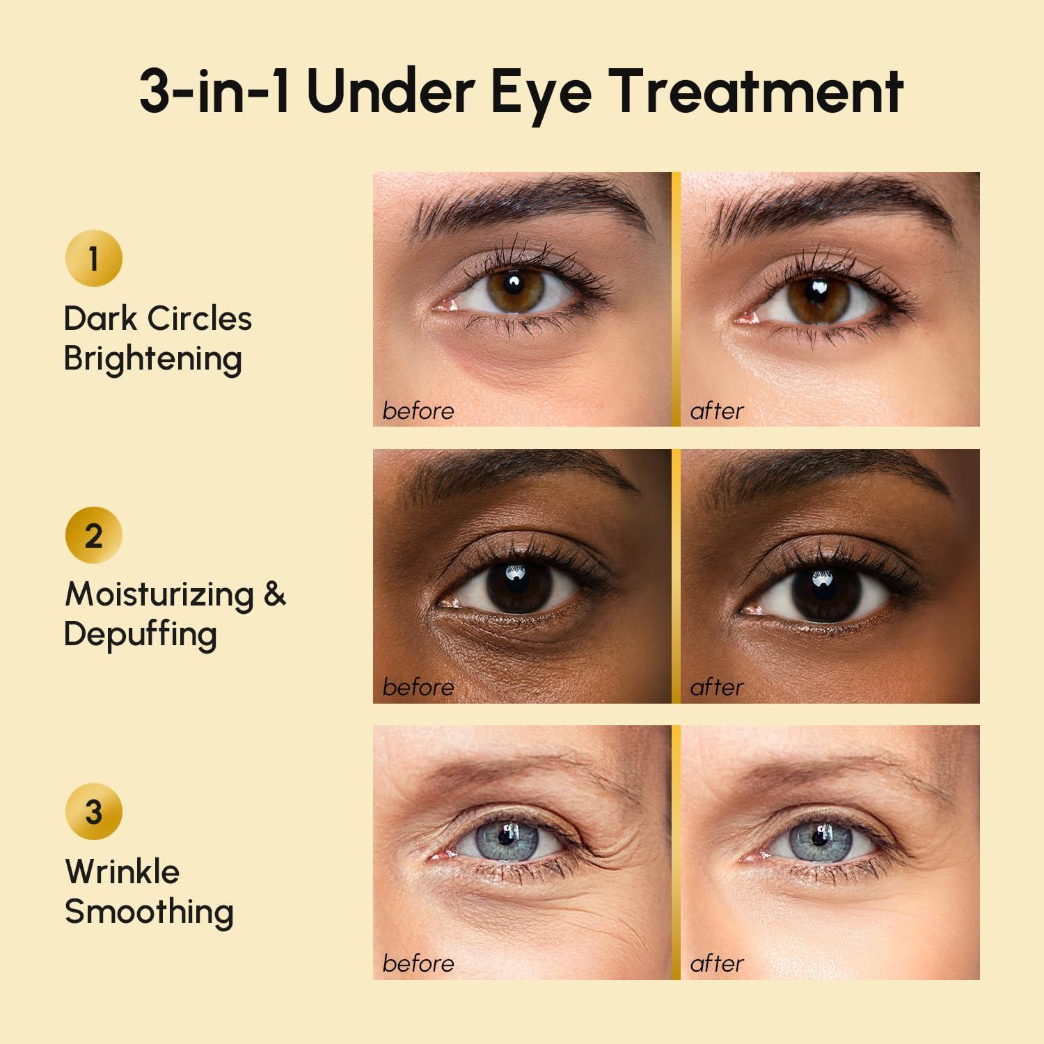 imageMAREE Eye Gels Cooling Pads Under Eye Patches for Puffy Eyes and Dark Circles with Collagen amp Hyaluronic Acid Anti Wrinkles Under Eye Masks Skincare Treatment for Puffiness Parches Para OjerasGold