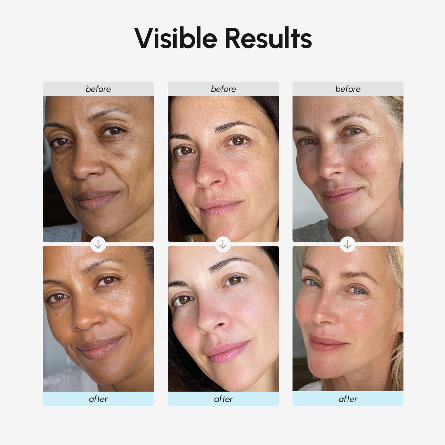 imageMAREE Face Moisturizer Retinol Cream for Face Daily Wrinkle Cream for Women AntiAging Face Cream Facial Moisturizer with Collagen Crema Hidratante Para la Cara for Skin Tightening17 Fl Oz Pack of 1
