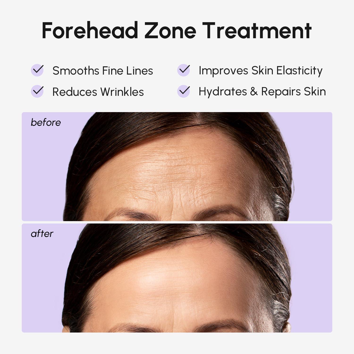 imageMAREE Forehead Wrinkle Patches Collagen Wrinkle Patches with Retinol amp Hyaluronic Acid for Face Lift Fine Lines Deep Forehead Wrinkles Treatment Remover Face Tape for Wrinkles Between Eyebrows