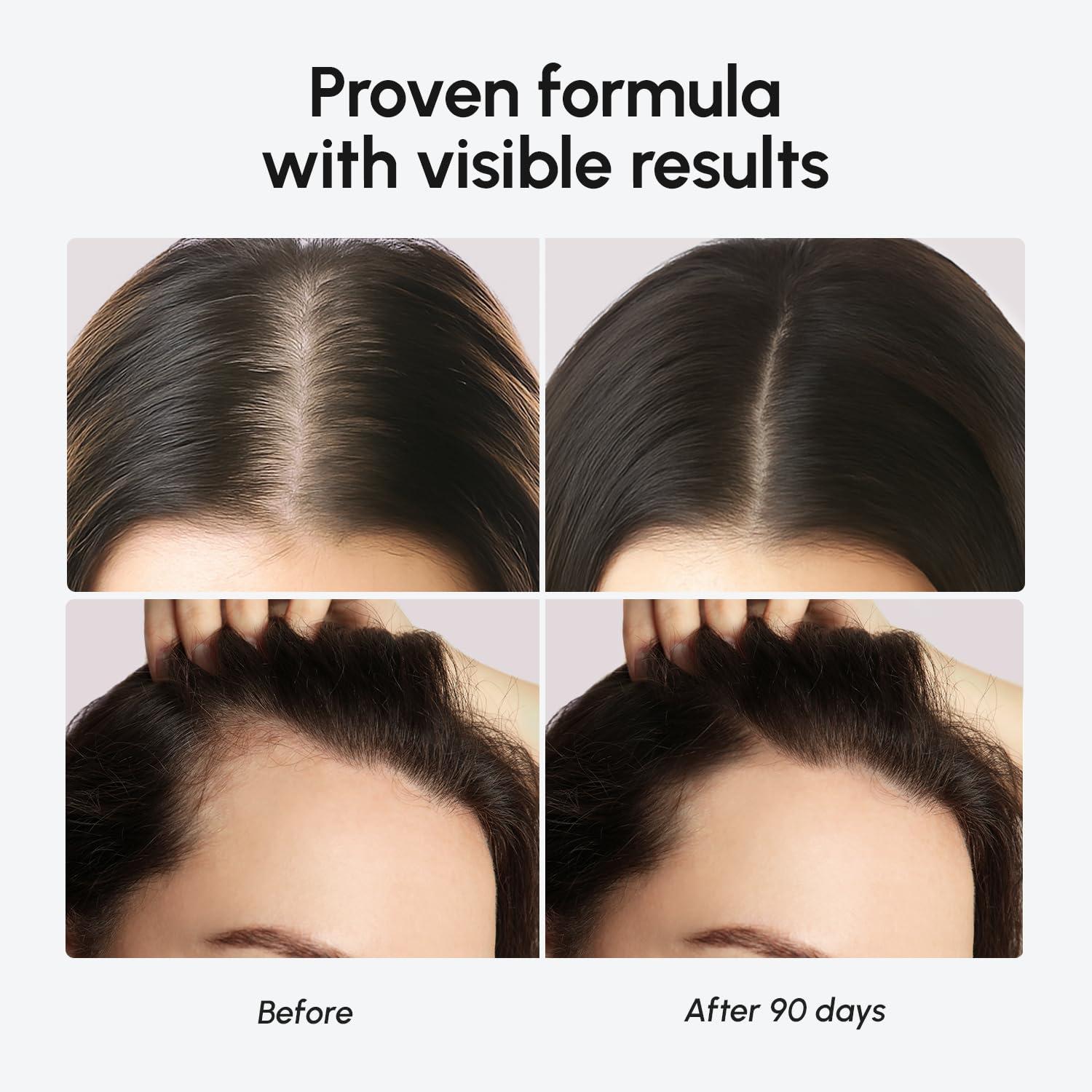 imageMAREE Hair Growth Spray Caffeine Batana Castor amp Rosemary Oil for Hair Growth Products for Women amp Men Hair Oils for Hair Growth Hair Thickening Spray for Roots Hair Regrowth amp Scalp CareHair Growth Serum