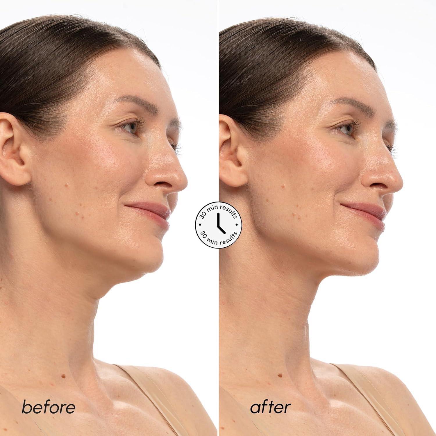 imageMAREE V Line Lifting Mask with 24K Gold Deep Collagen Face Mask for Women Jawline Shaper Mask with Retinol amp Hyaluronic Acid Neck Tightening amp Firming Double Chin Strap for Face LiftPDRN