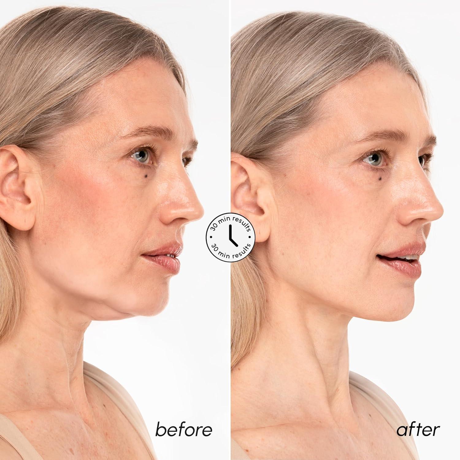 imageMAREE V Line Lifting Mask with 24K Gold Deep Collagen Face Mask for Women Jawline Shaper Mask with Retinol amp Hyaluronic Acid Neck Tightening amp Firming Double Chin Strap for Face Lift24K Gold