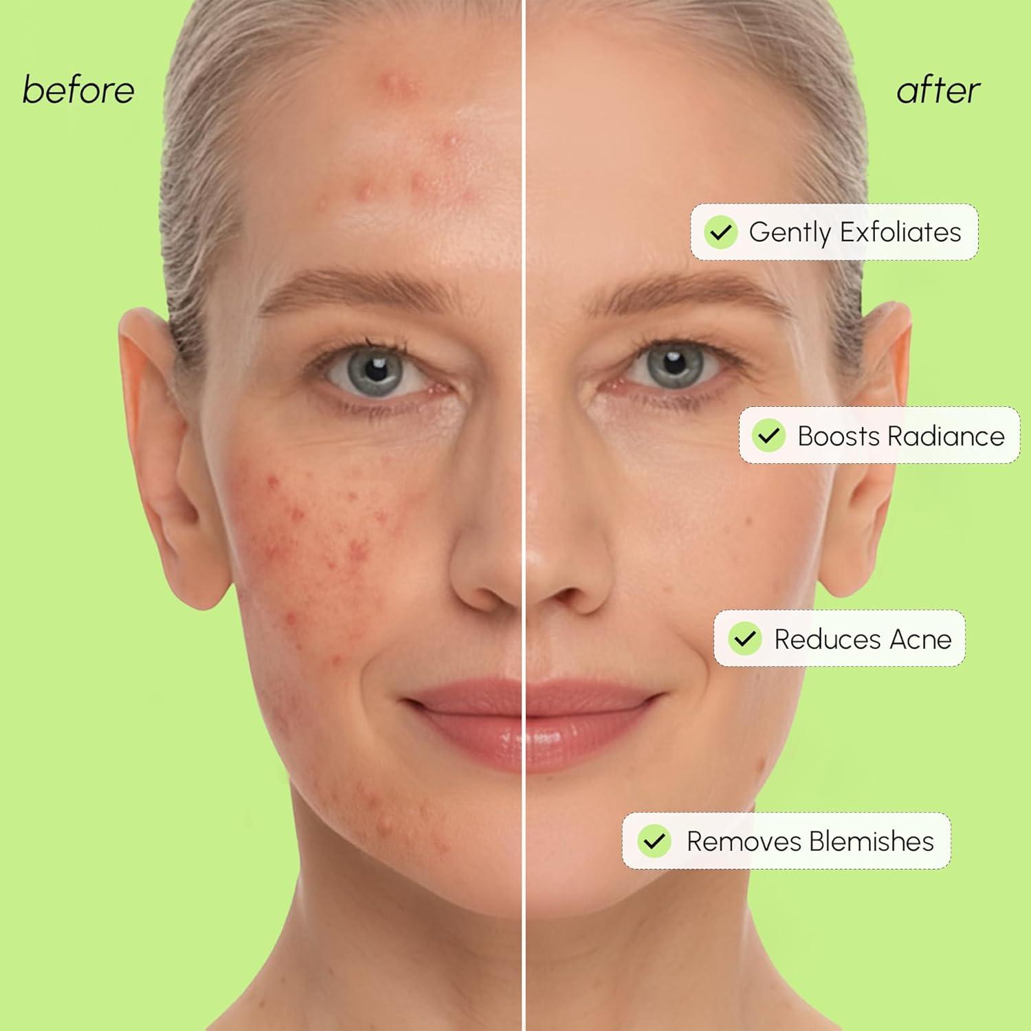 imageMAREE Exfoliating Toner with Salicylic Acid AHA BHA Face Exfoliant amp Pore Cleaner BHA Liquid Exfoliant for Sebum amp Dead Skin Care Remover Face Exfoliator Acido Salicilico Exfoliante FacialExfoliating