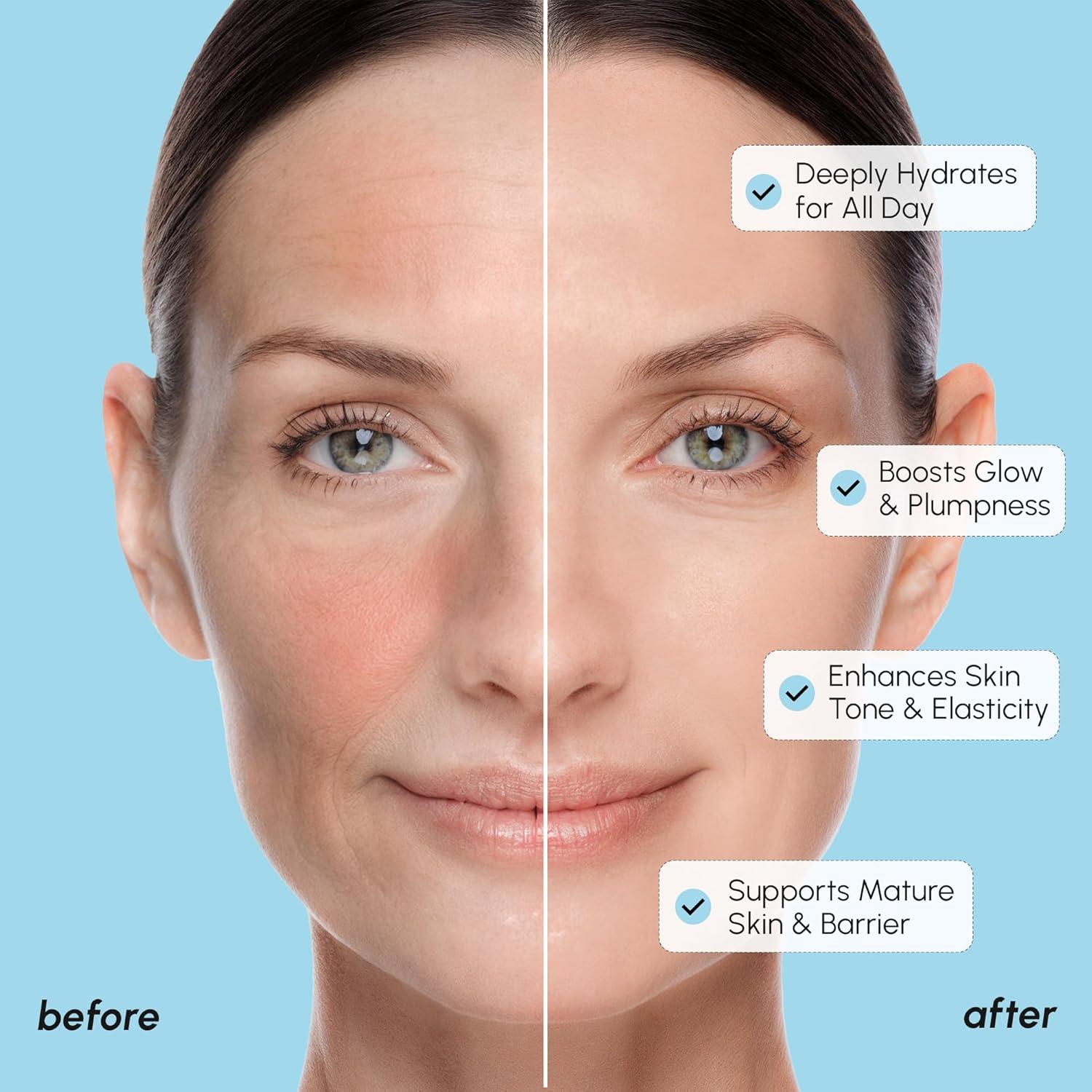 imageMAREE Exfoliating Toner with Salicylic Acid AHA BHA Face Exfoliant amp Pore Cleaner BHA Liquid Exfoliant for Sebum amp Dead Skin Care Remover Face Exfoliator Acido Salicilico Exfoliante FacialMilky
