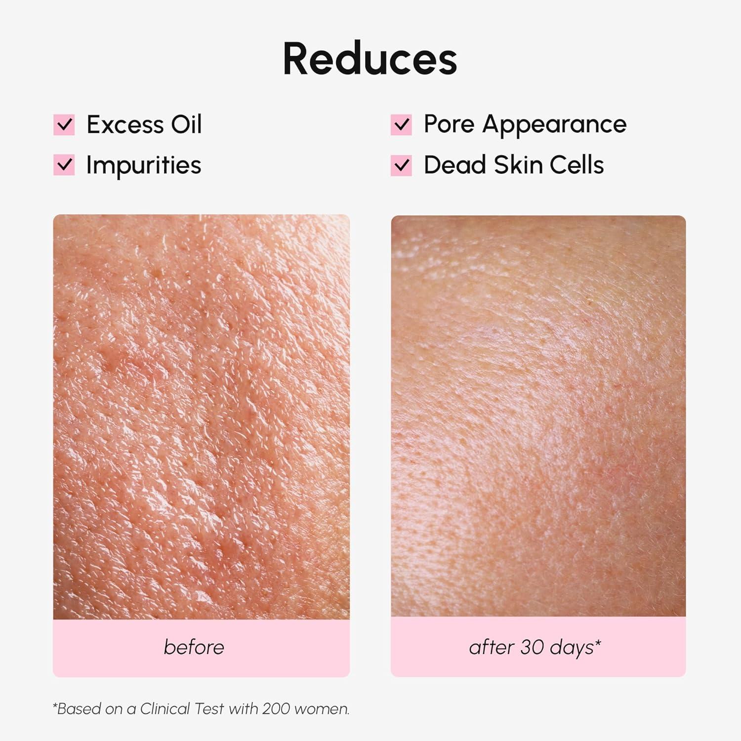 imageMAREE Exfoliating Toner with Salicylic Acid AHA BHA Face Exfoliant amp Pore Cleaner BHA Liquid Exfoliant for Sebum amp Dead Skin Care Remover Face Exfoliator Acido Salicilico Exfoliante FacialPore Minimizing