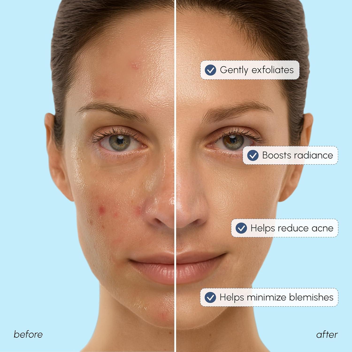 imageMAREE Exfoliating Toner with Salicylic Acid AHA BHA Face Exfoliant amp Pore Cleaner BHA Liquid Exfoliant for Sebum amp Dead Skin Care Remover Face Exfoliator Acido Salicilico Exfoliante FacialGlycolic Acid