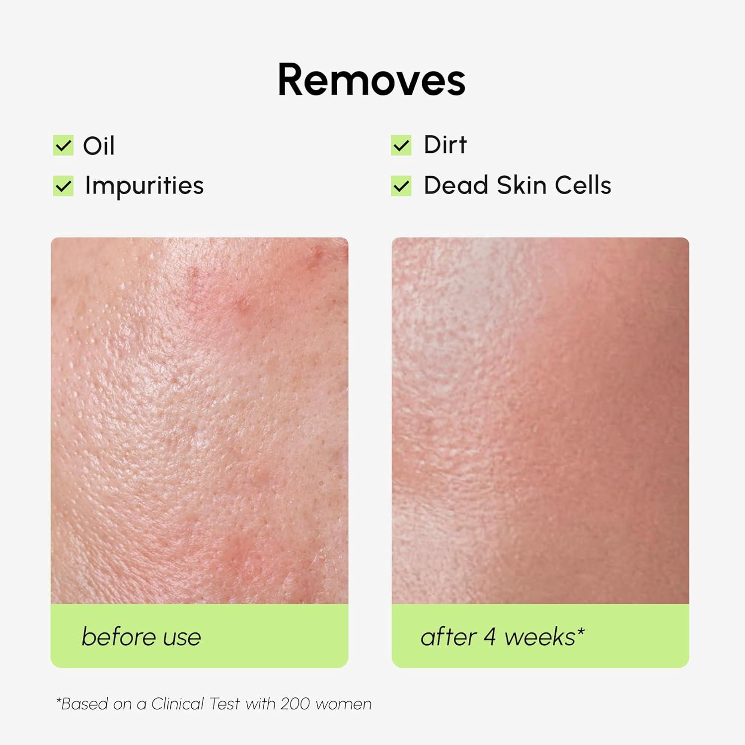 imageMAREE Exfoliating Toner with Salicylic Acid AHA BHA Face Exfoliant amp Pore Cleaner BHA Liquid Exfoliant for Sebum amp Dead Skin Care Remover Face Exfoliator Acido Salicilico Exfoliante FacialExfoliating