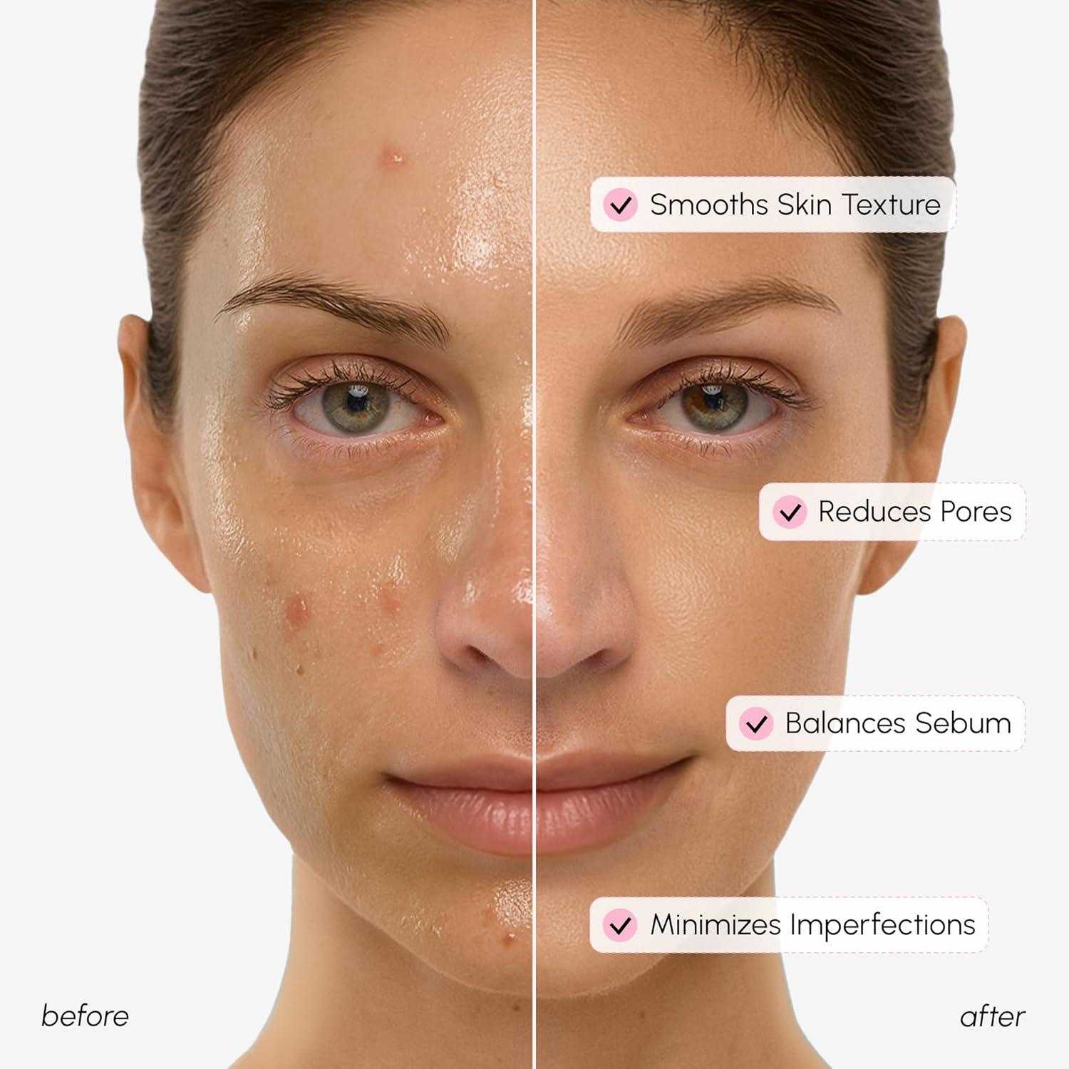 imageMAREE Exfoliating Toner with Salicylic Acid AHA BHA Face Exfoliant amp Pore Cleaner BHA Liquid Exfoliant for Sebum amp Dead Skin Care Remover Face Exfoliator Acido Salicilico Exfoliante FacialPore Minimizing