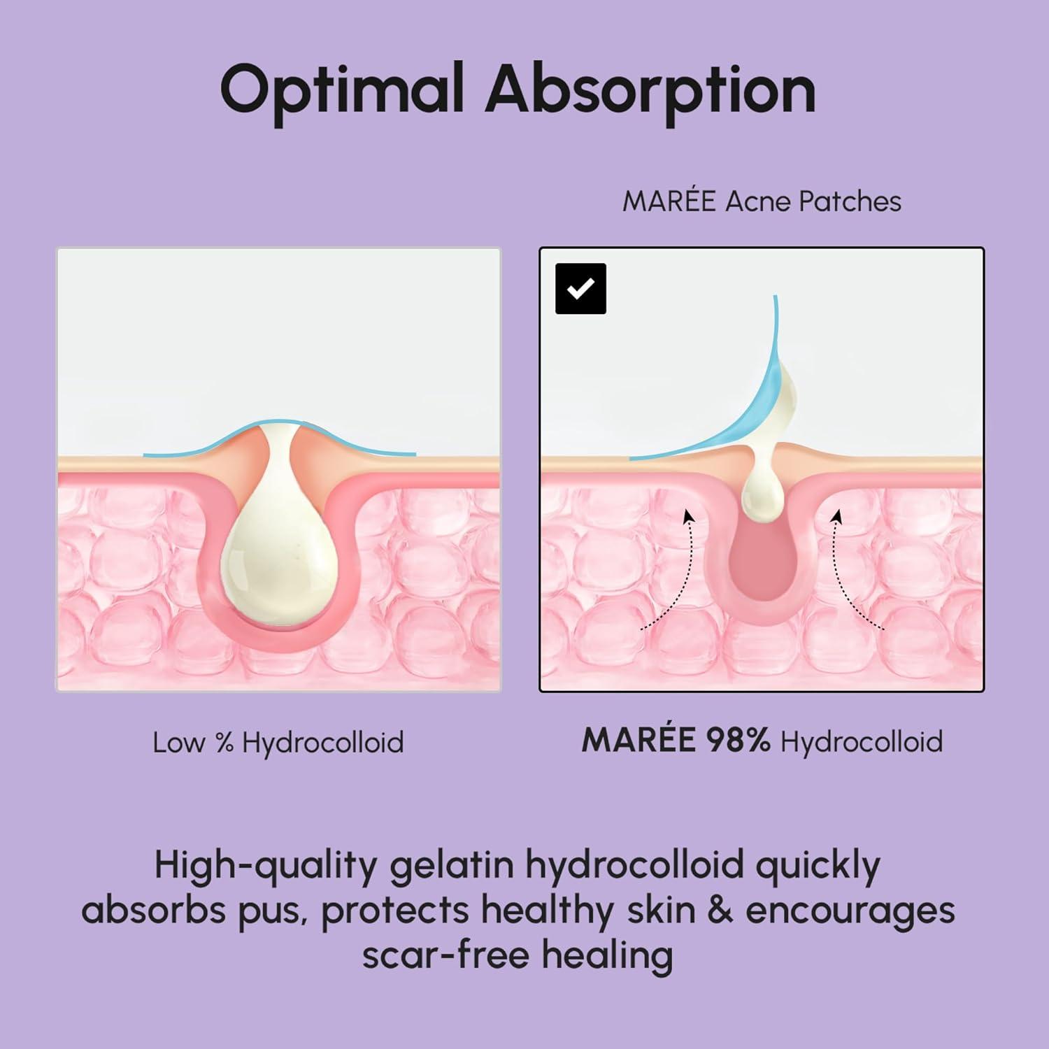 imageMAREE Invisible Pimple Patches Clear Pimple Patches for Face Hydrocolloid Acne Patches Anti Blemish Zit Stickers for Face Parches Para Acne Pinple Zit Patches Pimple Stickers 72 DotsHolographic