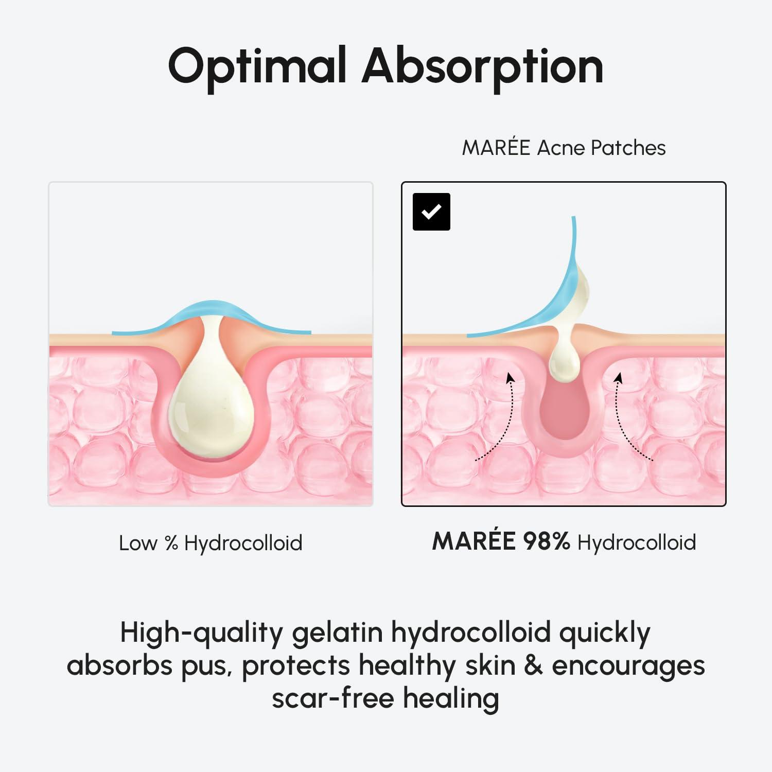 imageMAREE Invisible Pimple Patches Clear Pimple Patches for Face Hydrocolloid Acne Patches Anti Blemish Zit Stickers for Face Parches Para Acne Pinple Zit Patches Pimple Stickers 72 DotsClear