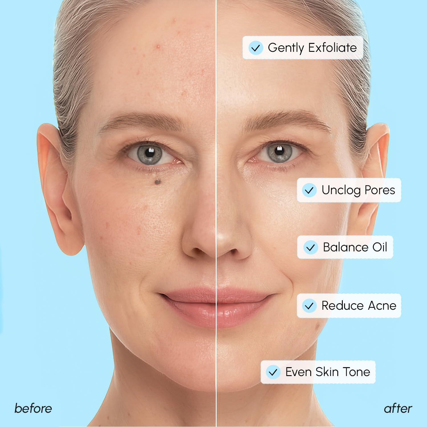 imageMAREE Glycolic Acid Pads Toner Pads for Face Cleansing Exfoliating Pad with Tea Tree Oil Salicylic Acid amp Vitamins E B3 B5 Acne Clearing Skin Pore Resurfacing amp Radiance Device 80 CountGlycolic Salicylic Pads