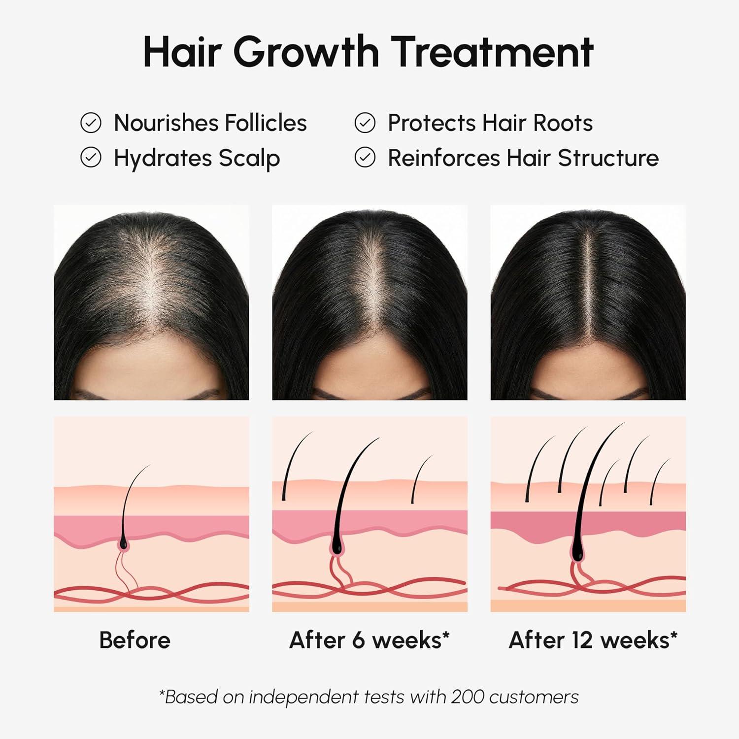 imageMAREE Batana Oil for Hair Growth 100 Natural Botana Oils Hair Growth Raw Batama Oil Paste from Honduras Density Thickness amp Scalp Soothing for Women and Men Aceite de Batana Para el Cabello49 Ounce Pack of 1