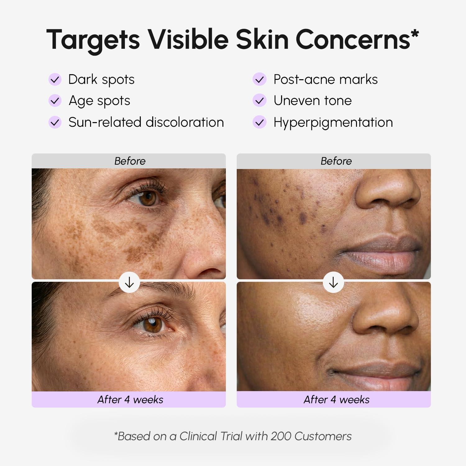 imageMAREE Dark Spot Remover for Face and Body Dark Spot Corrector Serum Hyperpigmentation Melasma Sun amp Age Spots Black amp Brown Spot Remover for Women Crema para Manchas Oscuras en la Cara34 Fl Oz Pack of 1