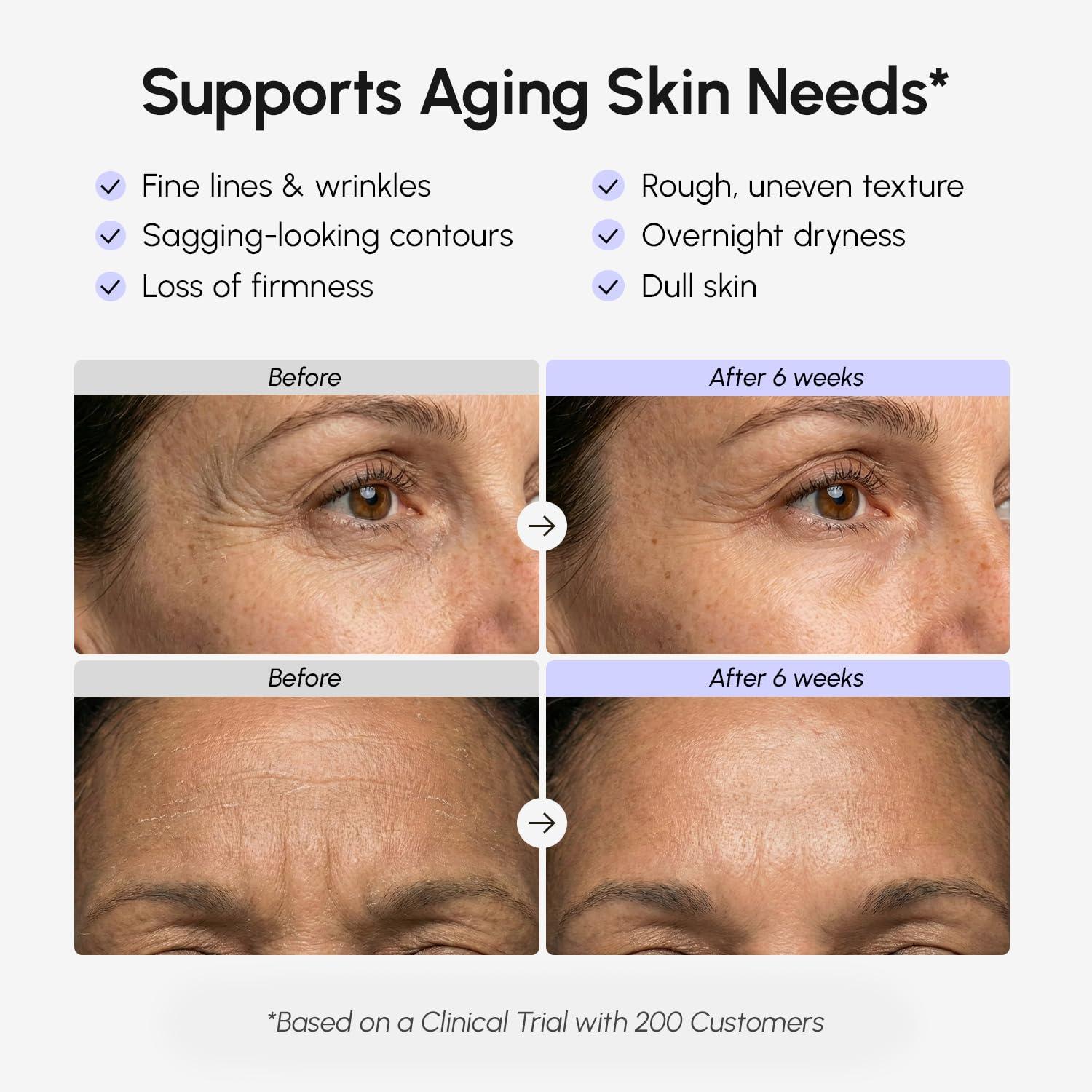 imageMAREE Face Moisturizer Retinol Face Cream for Women Moisturizing with Collagen amp Hyaluronic Acid Day amp Night AntiAging Facial Wrinkle DD Cream Moisturizer for Dry Skin Crema Para la CaraWrinkle Smoothing