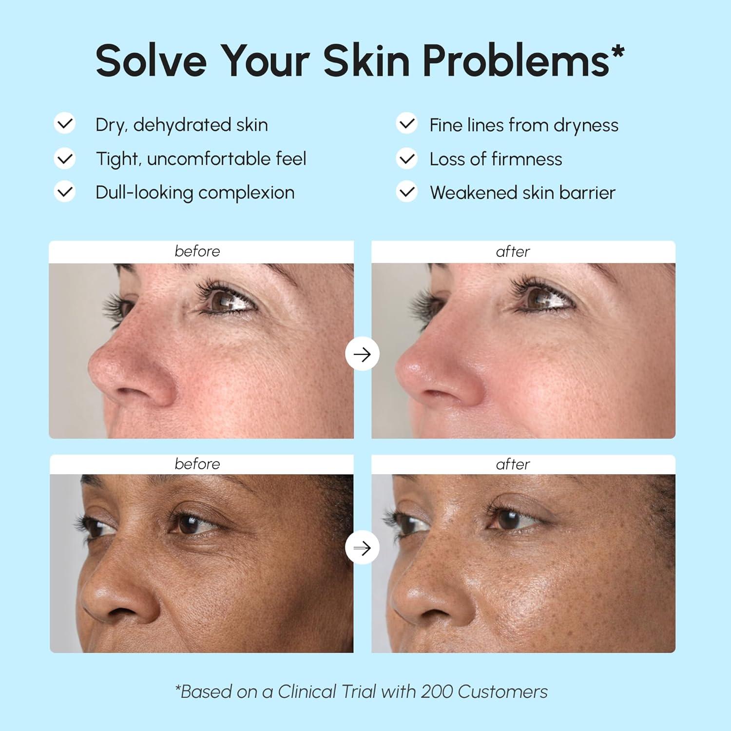imageMAREE Face Moisturizer Retinol Face Cream for Women Moisturizing with Collagen amp Hyaluronic Acid Day amp Night AntiAging Facial Wrinkle DD Cream Moisturizer for Dry Skin Crema Para la CaraFirming Lifting
