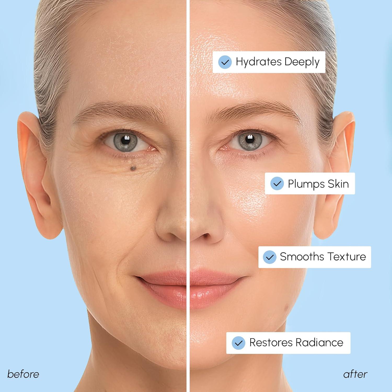 imageMAREE Hyaluronic Acid Toner Pads Hydrating Face Wipes for Women Cleansing Zero Pore Toning Brightening Exfoliating Face Pads Pore Reducer Facial Peels Acne Treatment DeviceSky Blue