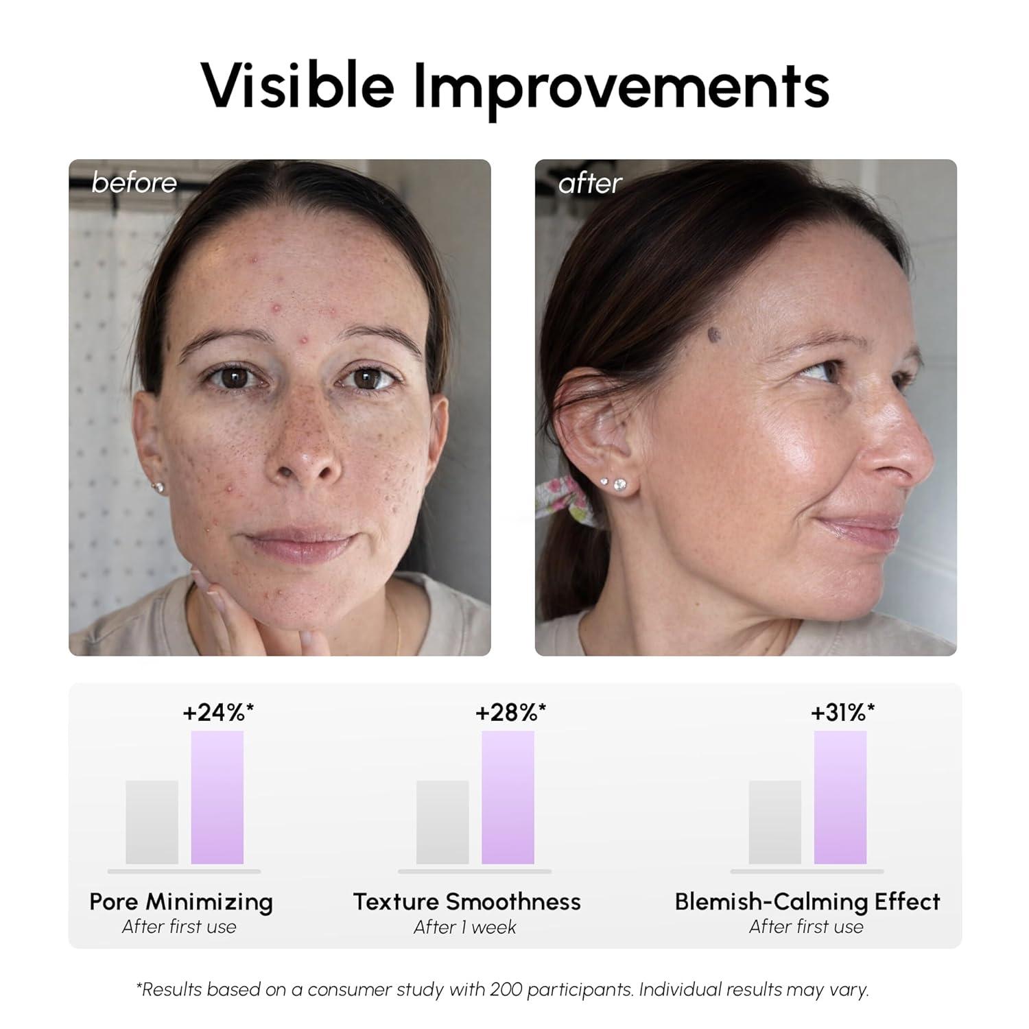 imageMAREE Hyaluronic Acid Toner Pads Hydrating Face Wipes for Women Cleansing Zero Pore Toning Brightening Exfoliating Face Pads Pore Reducer Facial Peels Acne Treatment DevicePurple