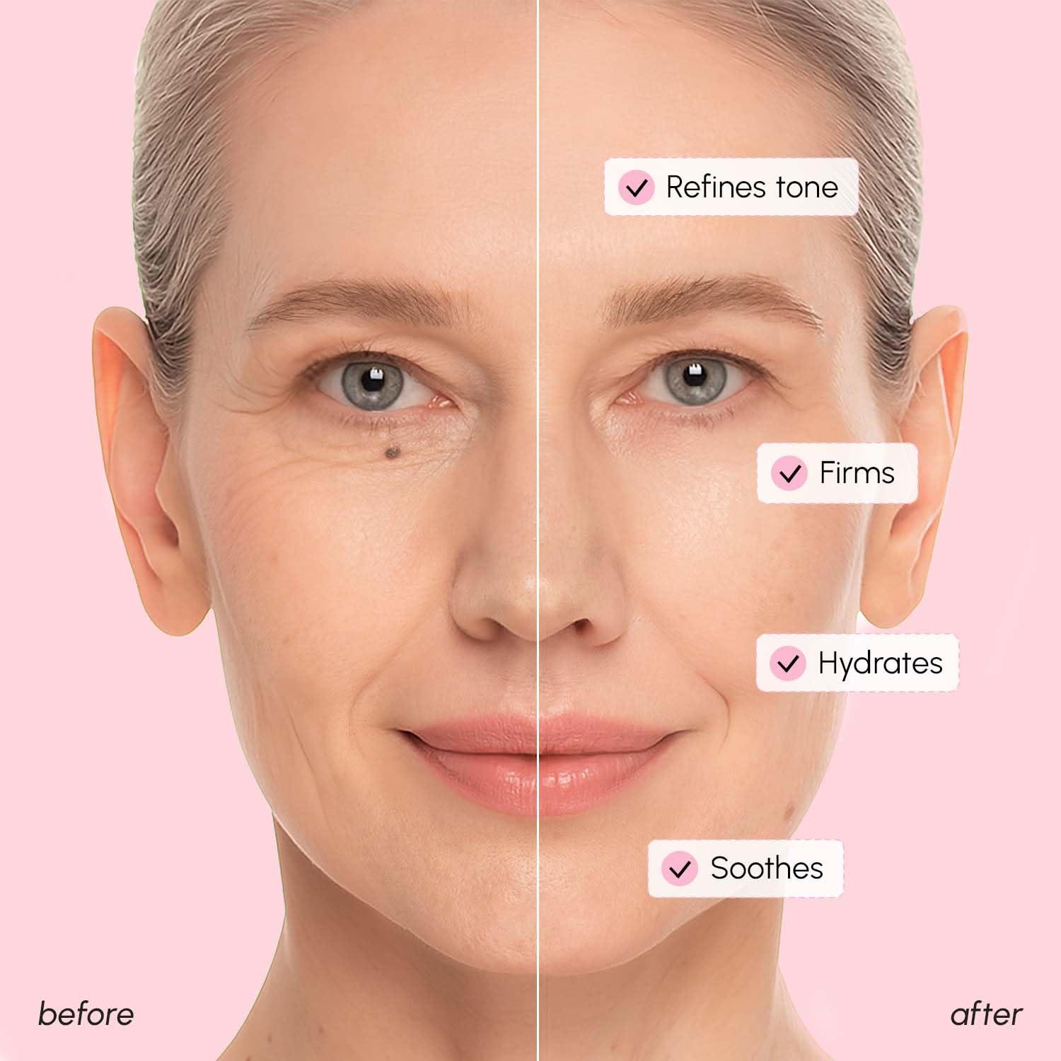 imageMAREE Hyaluronic Acid Toner Pads Hydrating Face Wipes for Women Cleansing Zero Pore Toning Brightening Exfoliating Face Pads Pore Reducer Facial Peels Acne Treatment DevicePink