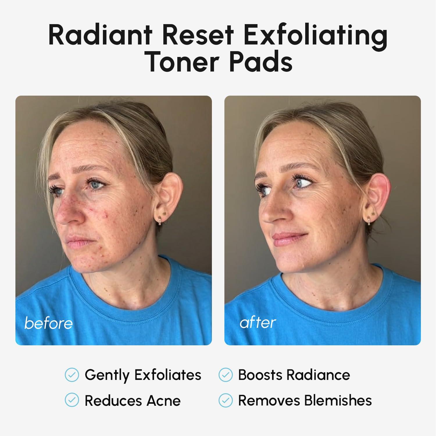 imageMAREE Hyaluronic Acid Toner Pads Hydrating Face Wipes for Women Cleansing Zero Pore Toning Brightening Exfoliating Face Pads Pore Reducer Facial Peels Acne Treatment DeviceBlue