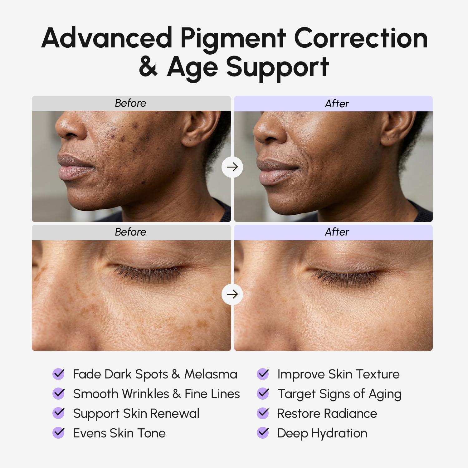 imageMAREE TXA Tranexamic Acid Serum Cream with Microspicules 100000 PPM Complex Alpha Arbutin Cream Face Crema para Manchas Oscuras en la CaraPurpl