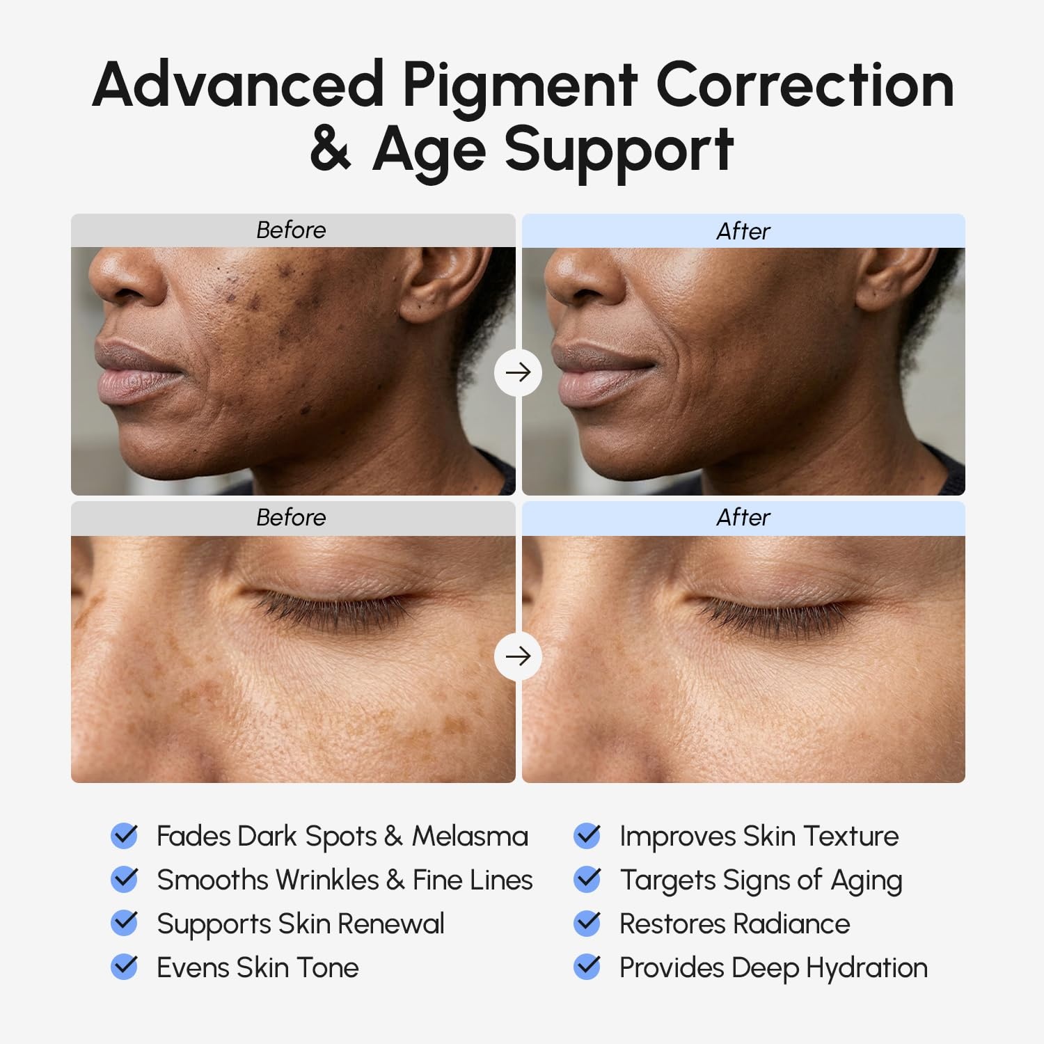 imageMAREE 10 Tranexamic Serum Cream Alpha Arbutin Cream with Tranexamic Acid Niacinamide Dark Spot Corrector with Alfa Arbutin Acido Tranexamico Crema para Manchas Oscuras en la CaraDark Blue