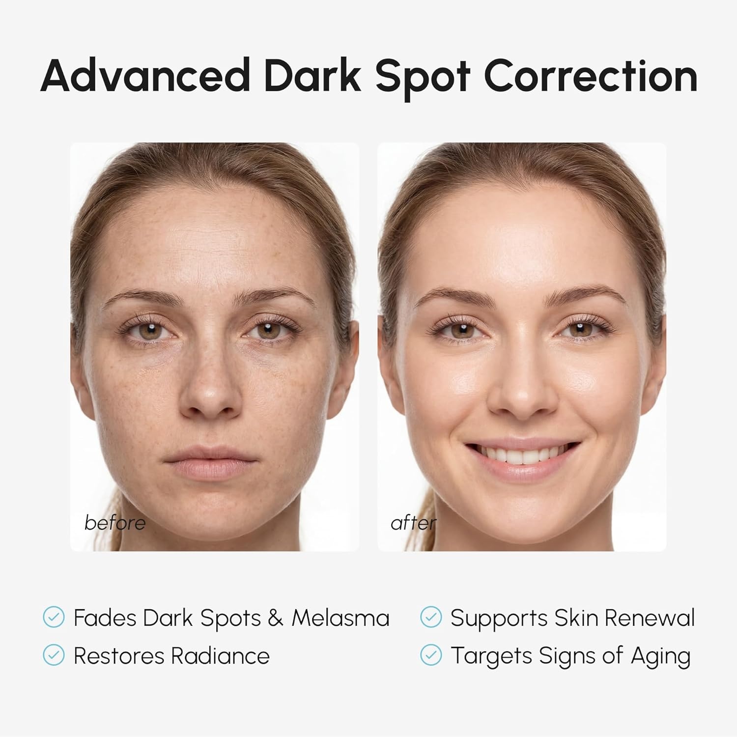 imageMAREE 10 Tranexamic Serum Cream Alpha Arbutin Cream with Tranexamic Acid Niacinamide Dark Spot Corrector with Alfa Arbutin Acido Tranexamico Crema para Manchas Oscuras en la CaraViolet