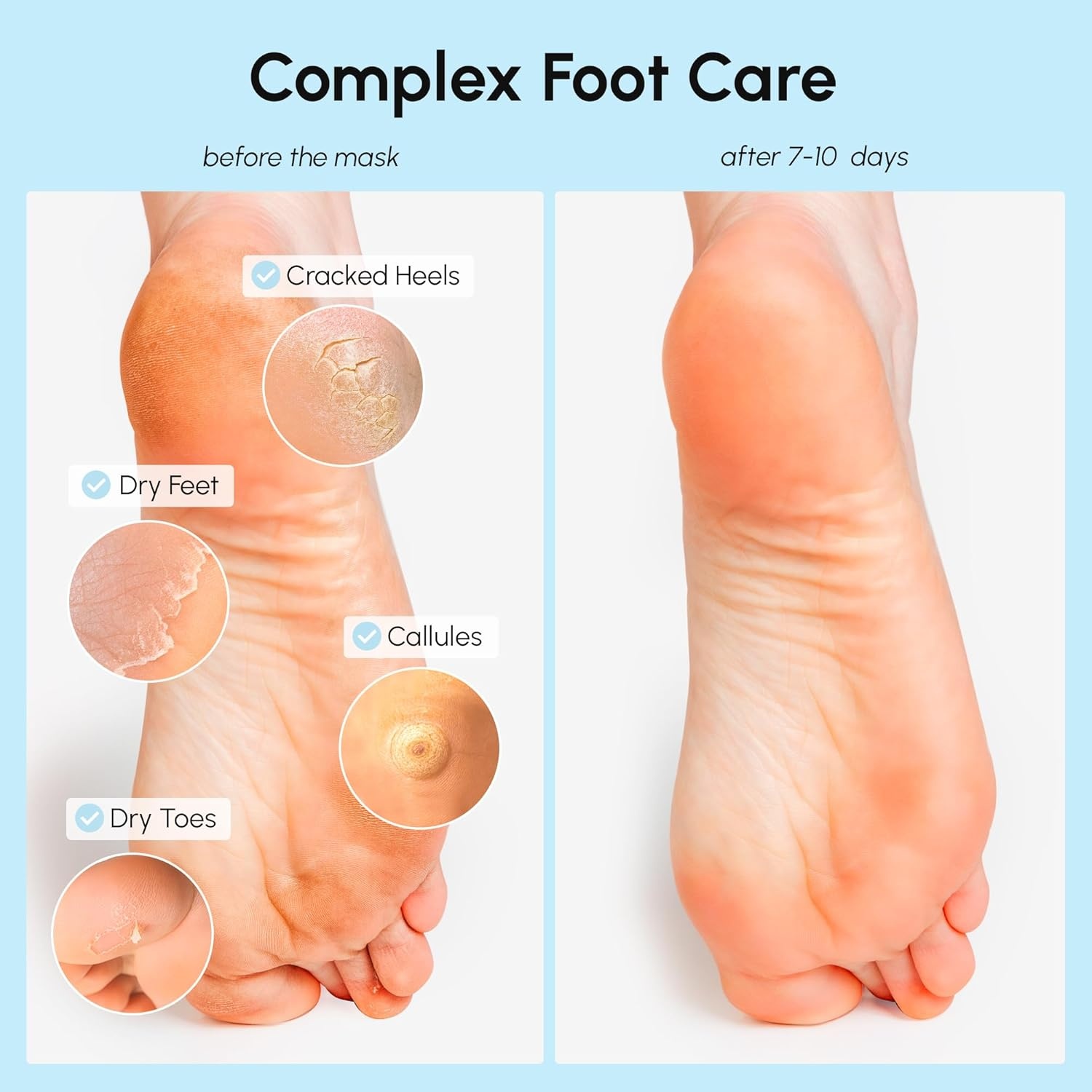 image:imageMAREE Foot Peeling Mask 3in1 Foot Mask for Dry Cracked Feet Callus Remover Dead Skin Exfoliating Foot Peel Mask with Glycolic Acid Moisturizing Socks for Men Spa Self Care Gifts for WomenCoconut
