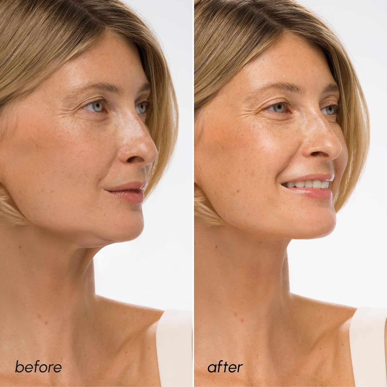 image:imageMAREE V Line Lifting Mask with PDRN Salmon DNA Deep Collagen Face Mask for Women Jawline Shaper Facial Masks with Retinol Tightening amp Firming Neck Lift Tape Double Chin Strap for Face LiftPurple