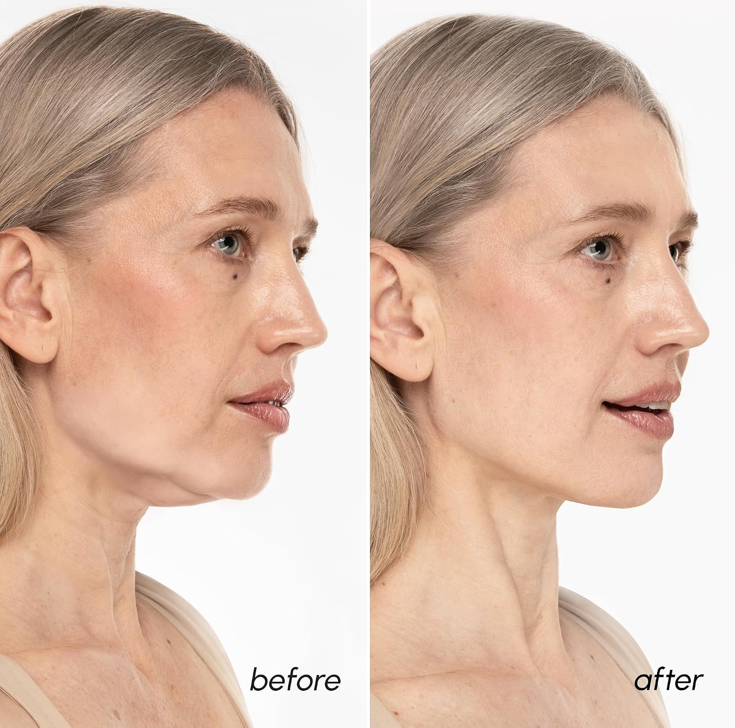 image:imageMAREE V Line Lifting Mask with PDRN Salmon DNA Deep Collagen Face Mask for Women Jawline Shaper Facial Masks with Retinol Tightening amp Firming Neck Lift Tape Double Chin Strap for Face LiftGold