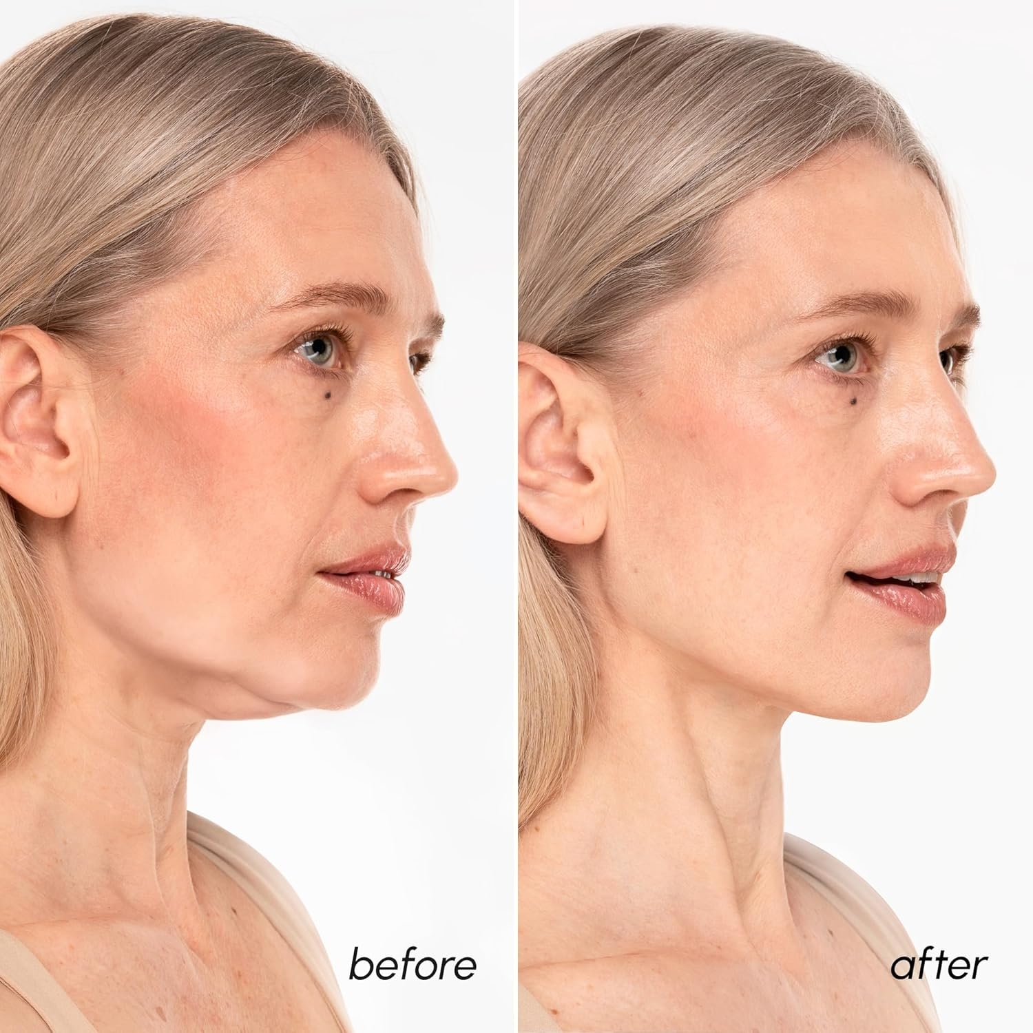 image:imageMAREE V Line Lifting Mask with PDRN Salmon DNA Deep Collagen Face Mask for Women Jawline Shaper Facial Masks with Retinol Tightening amp Firming Neck Lift Tape Double Chin Strap for Face LiftGold