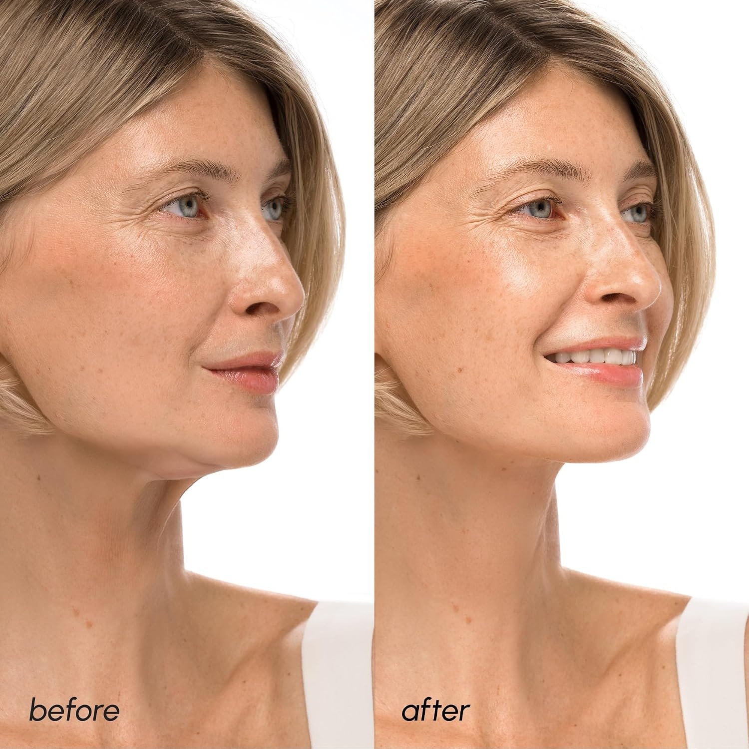 image:imageMAREE V Line Lifting Mask with PDRN Salmon DNA Deep Collagen Face Mask for Women Jawline Shaper Facial Masks with Retinol Tightening amp Firming Neck Lift Tape Double Chin Strap for Face LiftPurple